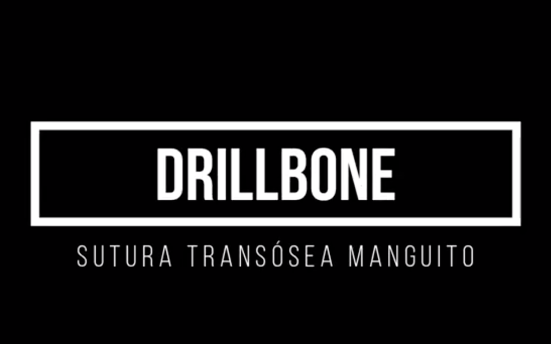 DrillBone - Técnica artroscópica